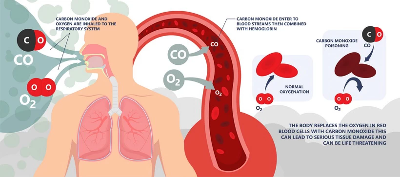 What causes carbon monoxide poisoning